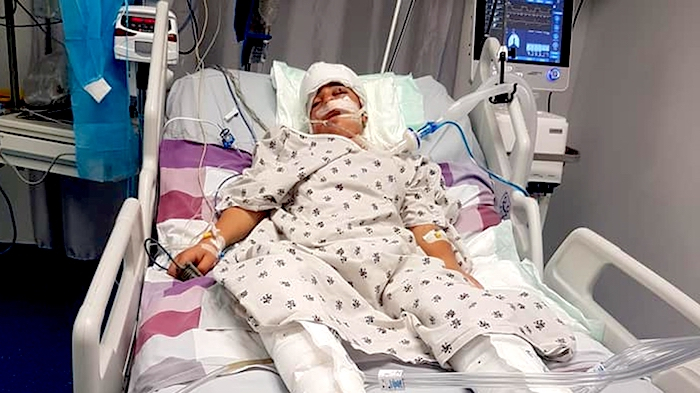 Mohammed Tamimi after being shot in the head by and IDF soldier, and in a medically induced coma.